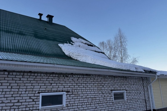 Монтаж снегозадержателей